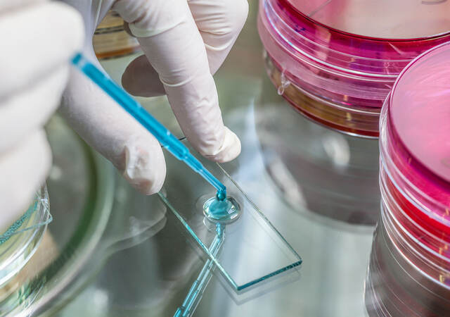 Tech using a pipette to place a specimen on a slide