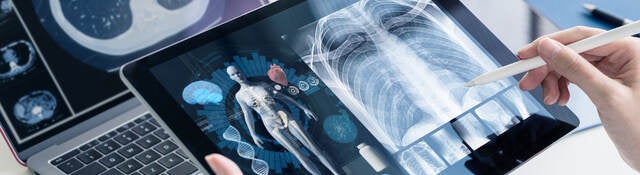 Software as a medical device (SaMD) x-ray images