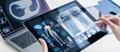 Software as a medical device (SaMD) x-ray images
