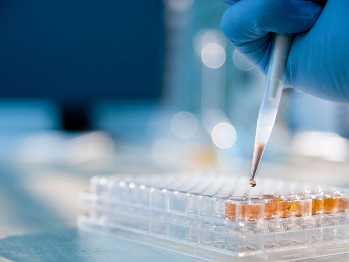 Closeup of a person pipetting a sample into vials